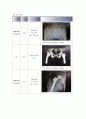 골절 케이스 9페이지