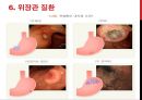 위,대장내시경 메뉴얼 24페이지