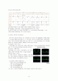 심전도의 이해 38페이지