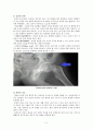 정형외과실습 대퇴경부 대퇴골 골절 케이스 스터디 femur neck fx fracture case study 6페이지