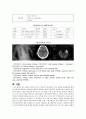 [동서협진과 CASE] 흉막삼출증 폐렴이 나타난 Cb-inf 환자 1례 2페이지