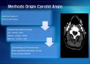 Carotid Angio CT에서 Jugular Vein Contrast Non Filling Method의 유용성 평가 6페이지