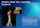 Carotid Angio CT에서 Jugular Vein Contrast Non Filling Method의 유용성 평가 11페이지