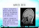 MRI(자기공명영상)의 소개 3페이지