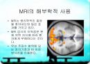 MRI(자기공명영상)의 소개 8페이지