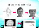MRI(자기공명영상)의 소개 13페이지