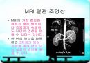 MRI(자기공명영상)의 소개 15페이지