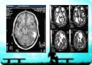 MRI(자기공명영상)의 소개 18페이지