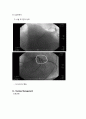 간호실습) 심근경색 흉부외과흉부외과실습병원실습간호학과실습간호학과casestudyMI 7페이지