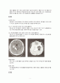 뇌출혈 케이스스터디 4페이지