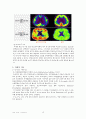 [A+노인] Dementia(치매) Case Study 낙상위험성 수면장애 문헌고찰 추천 10페이지