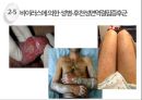 성병 - 각종 성병과 예방법 종류들에 관한 ppt 발표자료.pptx 19페이지