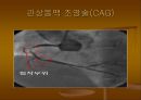 CAG (coronary angiography).ppt 23페이지