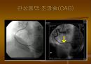 CAG (coronary angiography).ppt 24페이지