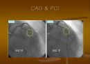 CAG (coronary angiography).ppt 27페이지
