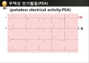 [PPT] 병원 현장에서의 심폐소생술 28페이지