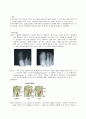 [성인간호학] 성인 골수염 (Osteomyelitis) 2페이지