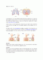 자연 기흉 (pneumothorax) 일차성 기흉  case study 2페이지