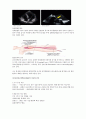 급성심근경색증(Acute myocardial infarction) 케이스 스터디 - 급성심근경색 급성심근경색 케이스 급성심근경색 간호과정 AMI CASE STUDY 6페이지