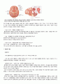 지주막하출혈(subarachnoid hemorrhage) 케이스스터디 7페이지