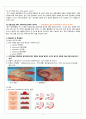 성인케이스 A+ 호스피스 위암말기 간호진단 7개 간호과정3개 호스피스 문헌고찰 위암 문헌고찰 4페이지