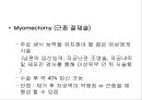 myoma 모성 간호학 컨퍼런스 11페이지