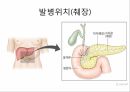 인슐린과 당뇨병인슐린이란인슐린 부작용인슐린의 종류 5페이지