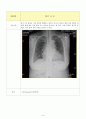 CHF(울혈성 심부전) CASE STUDY 9페이지