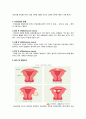 여성간호학 자궁근종(Leiomyoma of uterus) CASE  5페이지