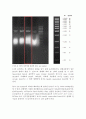 Gene Cloning 실험보고서 11페이지