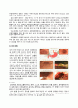 성인간호학실습 급성위염,급성간염 case (A+ 보장 간호진단 4개) 7페이지