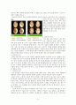 만성중이염 케이스스터디 간호진단3개,간호과정3개 4페이지