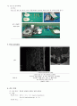 추간판 탈출증 환자를 대상으로 한 척추후궁절제술 사례 연구 11페이지