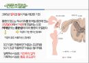 통증의지각과전달과정,통증의신경전달,통증신경회로,연관통증,근막통증후근,척수의신경로,오름조절,통증인지,전기치료 47페이지