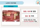 누인구강관리교육,노인의구강특성,노인의구강관리방법,올바른의치관리법,구강건조증 3페이지