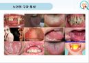 누인구강관리교육,노인의구강특성,노인의구강관리방법,올바른의치관리법,구강건조증 8페이지