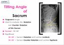 요추-골반의 방사선(x-ray) 분석법 4페이지