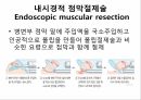 대장암의 진단 & 수술적 치료종류 7페이지