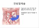 대장암의 진단 & 수술적 치료종류 11페이지