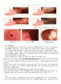 A+ 간호진단 3개 성인간호학실습 위염환자 케이스스터디 간호과정 6페이지