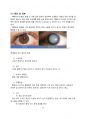 [레포트/4.5(A+) 자료] 백내장(cataract) 12페이지