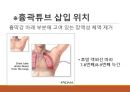 흉관배액관의 관리 및 간호 [PPT 발표자료] 24페이지
