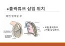 흉관배액관의 관리 및 간호 [PPT 발표자료] 25페이지