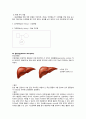 성인간호학실습 케이스스터디 (간경변증) [간호진단 및 간호과정 3개] 3페이지