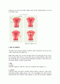 여성간호실습 자궁근종(uterine myoma), 자궁경부암(cervical cancer) 질병고찰(질병연구, 질병보고서, 문헌고찰) A+ 2페이지