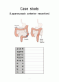 수술실 성인간호 간호과정 A+(복강경 로봇 위주 수술 필참) 1페이지