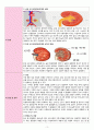 여성간호학실습 - 급성신우신염 A+ !!!!!!!!!!!!!!!!!!! 5페이지