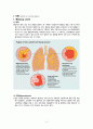 성인간호학_Case study_Lung cancer 4페이지