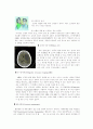 뇌졸증에 관한 논문이 필요합니다. 10페이지