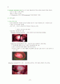 자궁근종 case study 2페이지